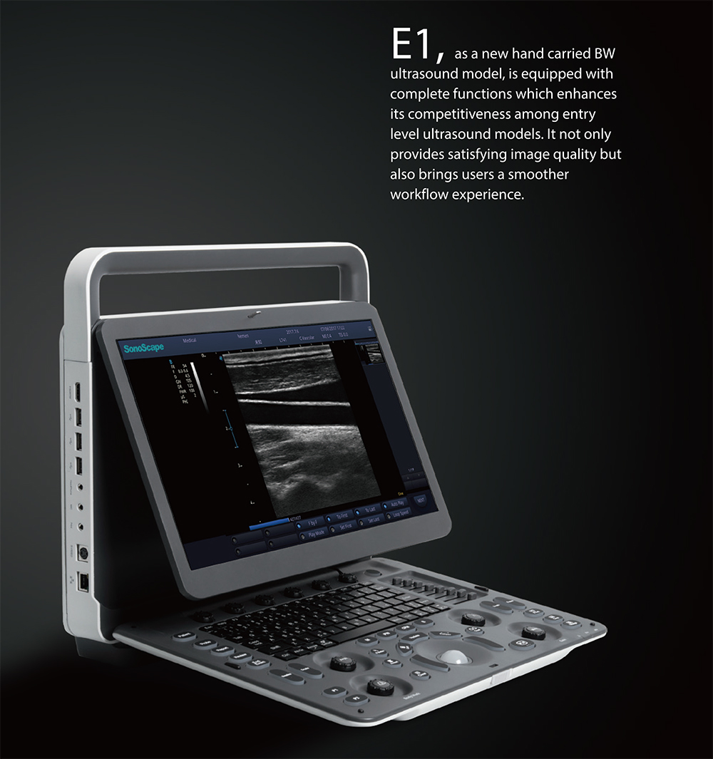 E1 BW Diagnostic Ultrasound System